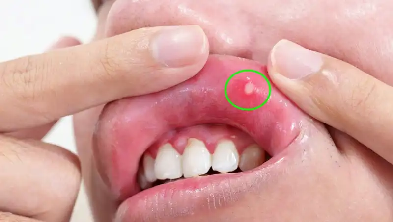 Vücudunuzda Gizli Belirtiler: 5 B Vitamini Eksikliği İşareti