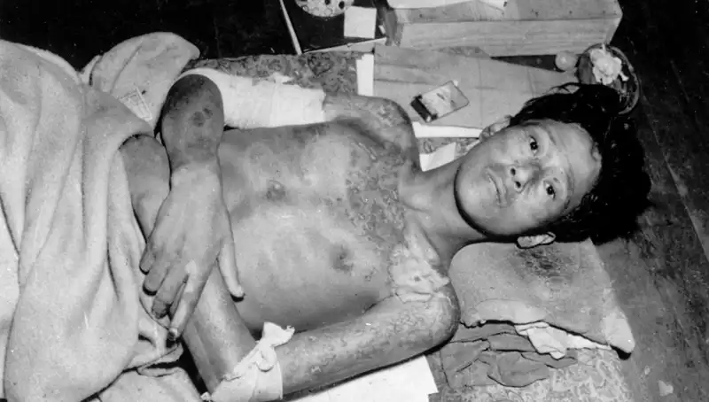 Nagasaki’den Yükselen Ses: 80 Yıl Sonra Nükleer Tehlike Yeniden Kapıda