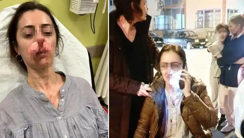 Otomobil Kapısı Korkunç Bir Silahtan Farksız: Aşk Üçgeni Facia Yarattı!
