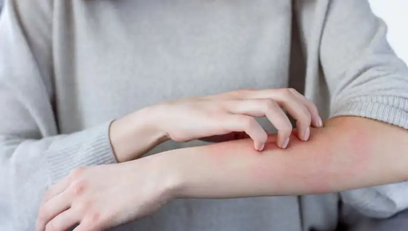 Cilt Kanserinin Gizli Belirtileri: Dermatologdan Çarpıcı Açıklamalar
