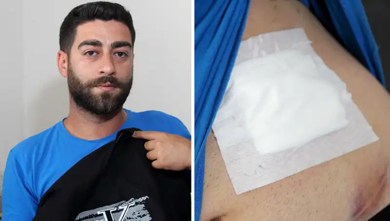 Karnındaki Ağrının Sebebi Röntgende Şok Edici Şekilde Ortaya Çıktı